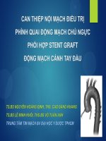 Can thiệp nội mạch điều trị phình động mạch chủ ngực đoạn quai, bảo tồn các nhánh nuôi não bằng stent thân động mạch cánh tay đầu