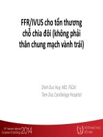 FFR IVUS cho tổn thương chỗ chia đôi (không phải thân chung mạch vành trái)