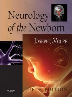Neurology of the newborn nodrm(1) 