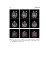 Nonrigid registration methods for myocardial perfusion mri and cerebral diffusion tensor mri 2 