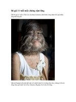 Bé gái 11 tuổi mắc chứng rậm lông