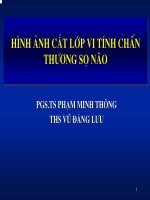 Hình Ảnh Cắt Lớp Chấn Thương Sọ Não
