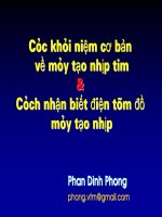 Hướng Dẫn Đọc Điện Tâm Đồ Máy Tạo Nhịp Tim