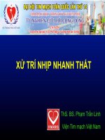 Xử Trí Nhịp Nhanh Thất