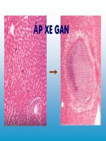 Bài giảng giải phẫu bệnh apxe gan