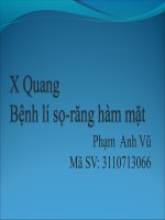 Bệnh lý x quang so mat