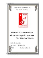 Máy chụp cắt lớp vi tính công nghệ chụp xoắn ốc