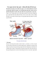 Trào ngược dạ dày thực quản - các triệu chứng và cách điều trị