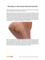 Mẹo phòng và chữa nứt gót chân mùa hanh khô