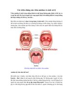 Các triệu chứng của viêm amidan và cách xử lý