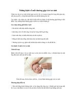 Những bệnh về mắt thường gặp ở trẻ sơ sinh