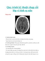Quy trình kỹ thuật chụp cắt lớp vi tính sọ não 
