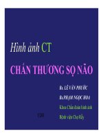 Bài giảng hình ảnh CT chấn thương sọ não   BS  lê văn phước, BS  phạm ngọc hoa