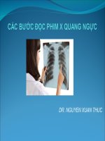 CÁC BƯỚC ĐỌC PHIM X QUANG NGỰC