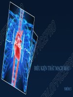 ĐIỀU KIỆN THẮT MẠCH MÁU