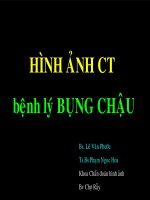hình ảnh CT bệnh lý bụng chậu, khoa chẩn đoán hình ảnh, bệnh viện chợ rẫy 