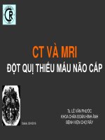 CT MRI ĐỘT QUỴ THIẾU MÁU NÃO CẤP