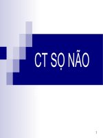 CHỤP HÌNH ẢNH CT SỌ NÃO