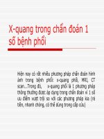 NỘI SOI X QUANG TRONG CHẨN ĐOÁN MỘT SỐ BỆNH PHỔI