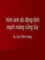 hình ảnh dò động tĩnh mạch màng cứng tủy trên mri