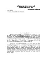 HÌNH ẢNH ĐIỆN TÂM ĐỒ NHỒI MÁU CƠ  TIM