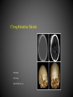 CT trong hình ảnh học thần kinh 1 