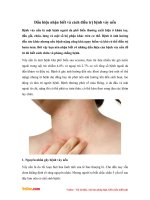 Dấu hiệu nhận biết và cách điều trị bệnh vảy nến