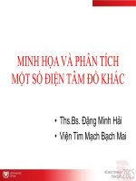 Minh họa và phân tích 1 số điện tâm đồ khác