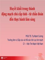 Huyết Khối Trong Thành Động Mạch Chủ Cấp Tính