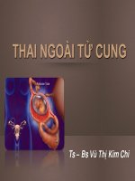 Bài Giảng Thai Ngoài Tử Cung