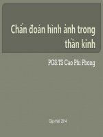 Chẩn đoán hình ảnh trong thần kinh