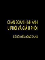 CHẨN ĐOÁN HÌNH ẢNH U PHỔI VÀ GIẢ U PHỔI BS NGUYỄN HỒNG QUÂN