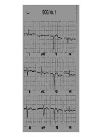 tai liệu về ecg dành cho người cơ bản