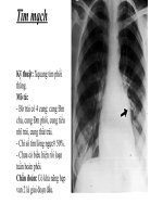 ôn tập chẩn đoán hình ảnh tim mạch (mô tả chuẩn) 