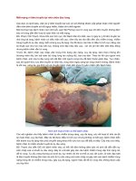 Mất mạng vì tiêm truyền tại nhà chữa đau lưng 