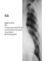 ôn tập chẩn đoán hình ảnh hô hấp (mô tả chuẩn) 