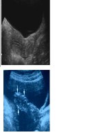 hình ảnh chẩn đoán hình ảnh phụ khoa 