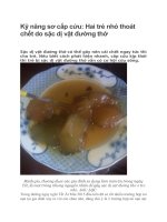 Kỹ năng sơ cấp cứu hai trẻ nhỏ thoát chết do sặc dị vật đường thở 