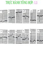 thực hành tổng hợp 1 điện tâm đồ 