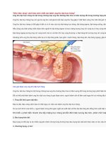 Dấu hiệu vàng cảnh báo sớm nhất căn bệnh ung thư đại trực tràng 