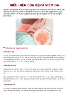 Biểu hiện của bệnh viêm da