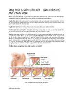 Ung thư tuyến tiền liệt căn bệnh có thể chữa khỏi