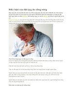 Biểu hiện của đột quỵ do nắng nóng 