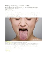 Những vị lạ ở miệng cảnh báo bệnh tật 