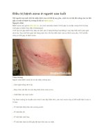 Điều trị bệnh zona ở người cao tuổi 