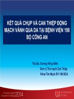 Kết quả chụp và can thiệp động mạch vành qua da tại BV 198 bộ công an 