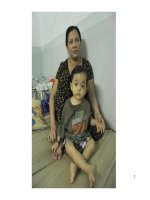 Bệnh xương đá   what is osteopetrosis 