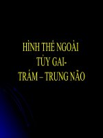 Hình thể ngoài tủy gai, trám não, trung não