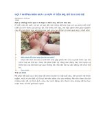 GỢI ý NHỮNG món QUÀ 1 