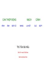 Can thiệp động mạch cảnh Hình ảnh đẹp sẽ mang tới kết cục đẹp